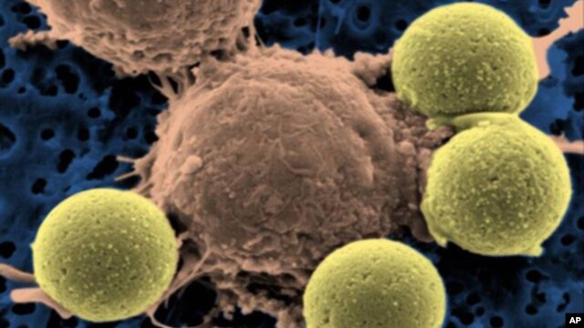This microscopy image provided by Dr. Carl June on Wednesday, Aug. 10, 2011 shows immune system T-cells, center, binding to beads which cause the cells to divide. The beads, depicted in yellow, are later removed, leaving pure T-cells which are then ready 