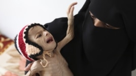 A woman holds her malnourished child at a feeding center at al-Sabyeen hospital in Yemen's capital, Sanaa, June 20, 2012.