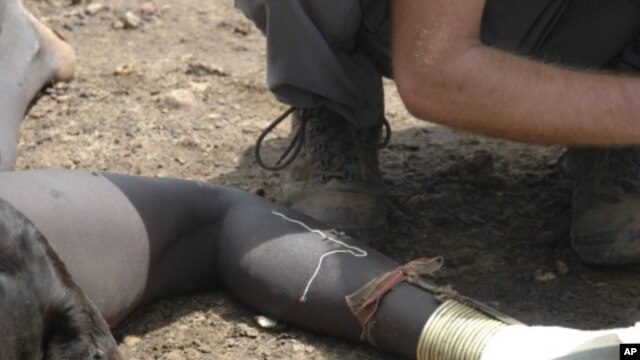 A guinea worm emerges from the leg of a south Sudanese girl in Juba. (File Photo)