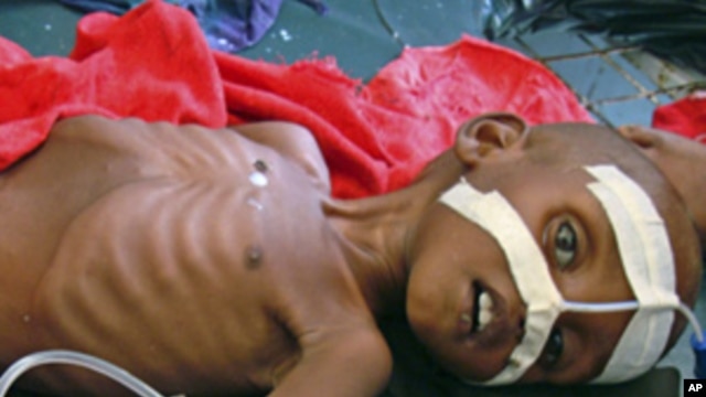 A malnourished child from southern Somalia lies in Banadir hospital in Mogadishu, July 13, 2011