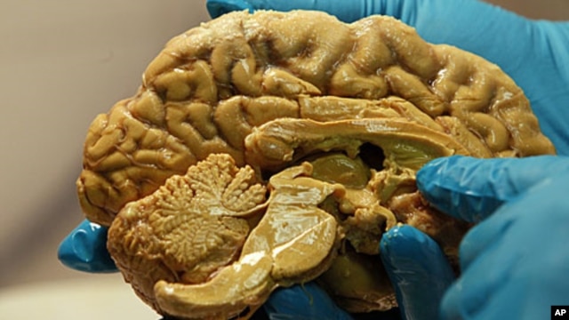 A researcher holds a human brain (file photo)