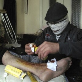 An injured man gets treated in a Damascus neighborhood, Syria, Tuesday, April 3, 2012.