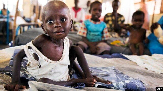Aleo Tong (1), who suffers severe malnutrition, rests on a bed at the MSF Nutrition centre in Aweil Hospital, on August 2, 2016.
