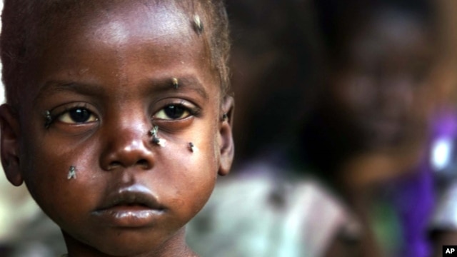 A starving child is covered with flies at the pediatric malnutrition ward at the Lilongwe Central Hospital, Malawi. (file photo)