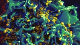 A scanning electron micrograph shows HIV particles infecting a human H9 T cell, colorized in blue, turqoise, and yellow. (Credit: NIAID)