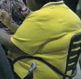 An obese person might not only die sooner, but could also experience years of poor health.