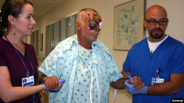 Ronald Poppo perdió un ojo, tiene severamente dañado el otro y la parte superior del rostro totalmente lesionada.