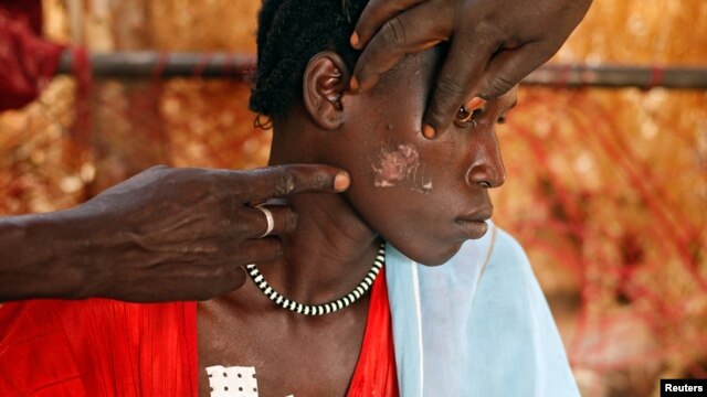 A Nuba woman, injured during a raid by Sudan's air force, sits in a makeshift hospital in South Kordofan in April 2012. 