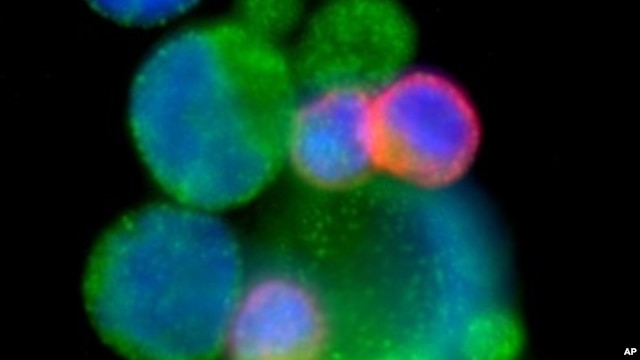 Image shows circulating tumor cell cluster of patient in unrelated study (undated file image).