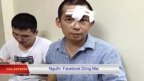 Truyền hình vệ tinh VOA 12/7/2016