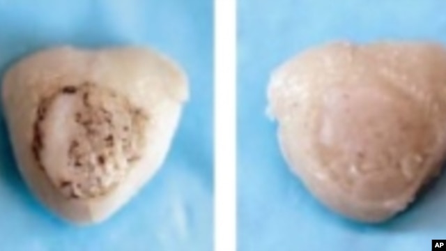 Various stages of cartilage growth on scaffold. The final image on the right shows naturally forming cartilage for comparison.