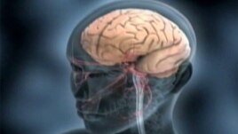 Động kinh do sự phát sinh quá độ điện trong não bộ khiến cho một người có các cử động bất thường hay bị hôn mê hoặc trong một số trường hợp có các cảm giác bất thường.