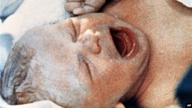 Dengan teknik pembuahan terbaru yang disebut bayi tabung 3-induk, cacat lahir akibat kesalahan genetika dalam DNA seorang ibu bisa dicegah, namun memicu kontroversi baru di Inggris (foto: dok).