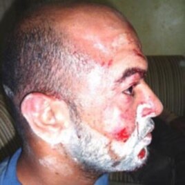 Bahraini citizen Sayed Abbas Sayed Mahdi is listed by the Bahrain Center for Human Rights as a victim of beatings by security forces