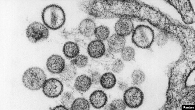 Los Centros para la Prevención y Control de Enfermedades de EE.UU. presentaron esta imagen microscópica del hantavirus.