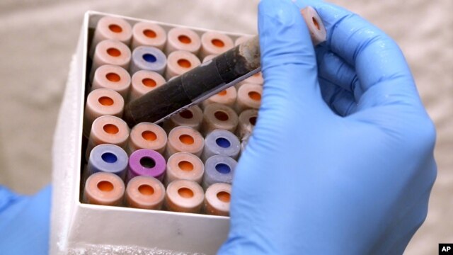Một nhà khoa học nghiên cứu các yếu tố liên quan đến cuộc thử nghiệm về máu mới, tại Đại học Duke, ở Durham, North Carolina