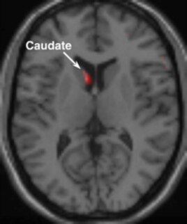 The caudate nucleus portion of the brain, which is associated with passion, becomes aroused when someone is shown a picture of a person with whom he or she is in love.