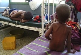 A malnourished child from southern Somalia sits on the bed at Banadir hospital in Mogadishu, Somalia.