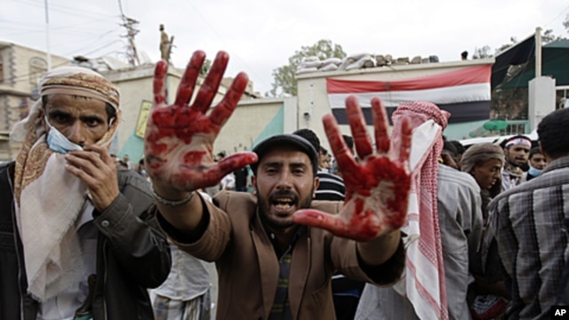 An anti-government protester holds out his blood-stained hands after clashes with security forces, in Sanaa, Yemen, September 18, 2011.