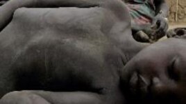 A four-year-old South Sudanese boy who collapsed from hunger lies on the ground at a feeding center run by Medecins Sans Frontieres in 2005. Eight years later, malnutrition is again stalking children in Northern Bahr el Ghazal state. (AP)