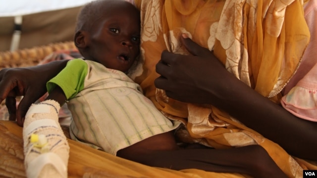 A malnourished baby in a hospital run by Doctors Without borders in Jamam, Upper Nile state, June 20, 2012 (Hannah McNeish/VOA).