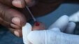 Blood is taken from someone’s finger to test it for HIV at Bulungula, South Africa  (D. Taylor/VOA)