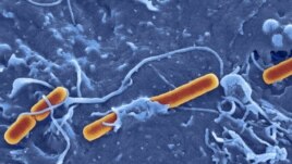 Shigella Sonsei bacterium (phto by Dave Goulding)