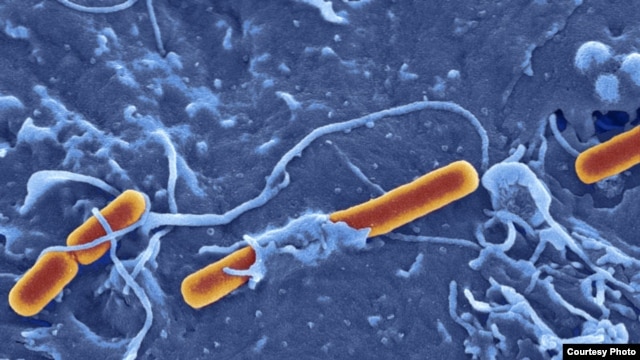 Shigella Sonsei bacterium (phto by Dave Goulding)