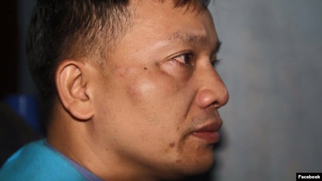 Luật sư Nguyễn Văn Đài sau khi bị tấn công ở Nghệ An hôm 6/12 (Ảnh: Facebook).