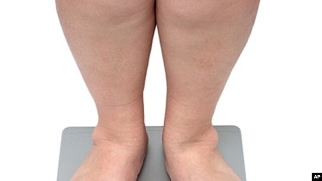 Sepsis is much more likely to kill obese patients and a high-fat, high-calorie diet might be the reason why, over-stimulating the body's immune response to the sepsis infection.