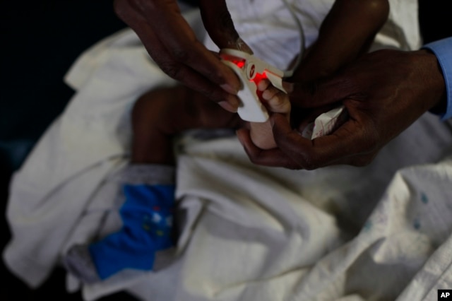 FILE - A doctor puts a heart monitor on the foot of a baby who is suffering from severe malaria in the Siaya hospital in western Kenya.