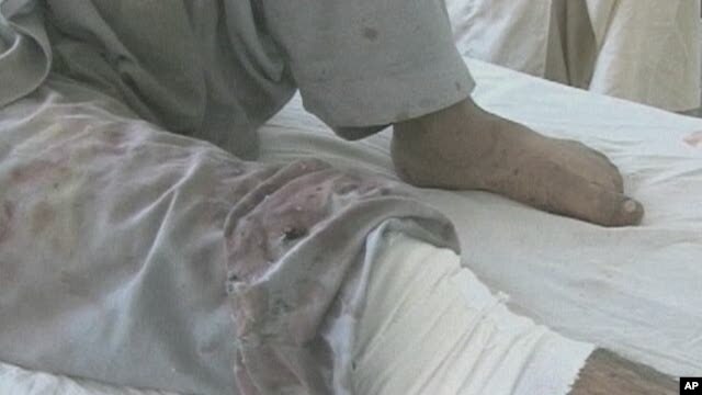 Trauma Expert: US Hospitals Not Equipped for Aftermath of Car Bombing