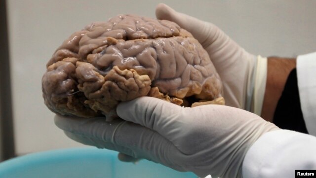 Los científicos han logrado reproducir exitosamente el Alzheimer en las células del cerebro humano en una caja de Petri