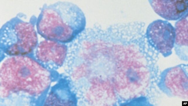 Boston researchers have developed a topical agent that might block the HIV virus from infecting healthy cells when it enters the body.