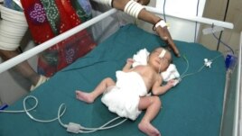 a Premature Baby in India has medical tape placed on her face. 