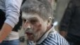 An injured man reacts at a site hit by airstrikes in the rebel-held area of Aleppo's Bustan al-Qasr, Syria, April 29, 2016.