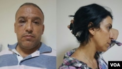 VOA Turkish’s Mahmut Bozarslan (L) and VOA Kurdish's Hatice Kamer (R) after being attacked in Midyat, Turkey on June 8.