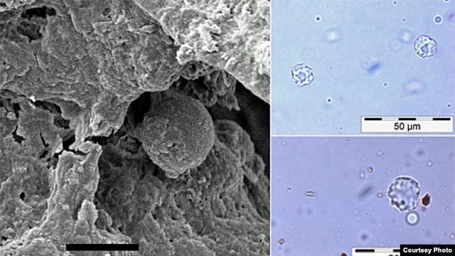 Microscopic fossils of 6,000-year-old garlic mustard seed, the earliest recorded use of a spice in cooking. (Courtesy of University of York, BioArCh)