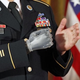 With his prosthetic hand, U.S. Army Sergeant First Class Leroy Arthur Petry applauds fellow soldiers during a ceremony in which he was presented with the Medal of Honor by U.S. President Barack Obama at the White House, July 12, 2011