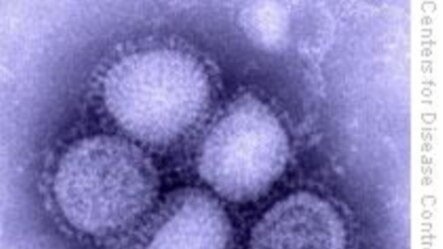 Yon foto viris H1N1 an (Sous; Sant Kontwòl Maladi Atlanta a (CDC) Ozetazini)