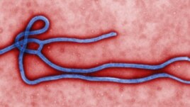Picha ya mfano wa virusi vya ugonjwa wa ebola