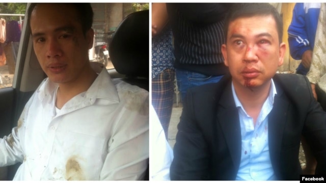 Luật sư Trần Thu Nam (phải) và Luật sư Lê Văn Luân sau khi bị hành hung. Vụ việc xảy ra hôm 3/11 khi luật sư Nam và Luân tới nhà bà Đỗ Thị Mai, mẹ của thiếu niên Đỗ Đăng Dư, người đã bị tử vong trong lúc bị giam giữ.
