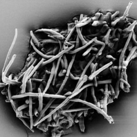 Scanning electron micrograph of fossil ectomycorrhiza which leached out of the amber fragment.