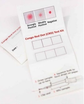 The Congo Red Dot test is a simple clinical tool that allows for accurate, rapid diagnosis of preeclampsia, a new study shows. (Photo courtesy of Ohio State University Wexner Medical Center)