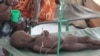 South Sudan Cholera Cases, Deaths on Rise