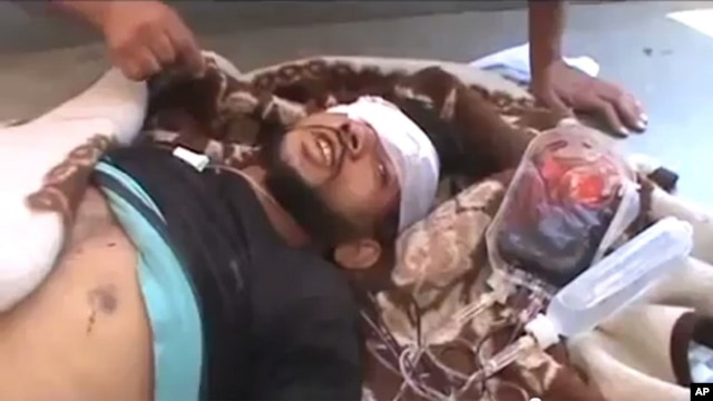 Citizen journalism image made from video provided by Shaam News Network SNN, purports to show a victim wounded by violence that, according to anti-regime activists, was carried out by government forces in Tremseh, Syria, July 12, 2012.