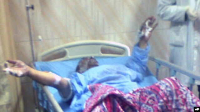 Restaurant owner Abdouh Abdel Moneim, 49, lies in a hospital bed after he had set himself on fire near the parliament in Cairo, 17 Jan 2011