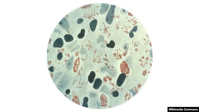 Mycobacterium leprae, bakteri penyebab penyakit kusta, menulari sel-sel saraf khusus di lengan dan kaki yang melindungi sinyal listrik dari otak yang dikenal sebagai sel-sel Schwann (foto: dok). 