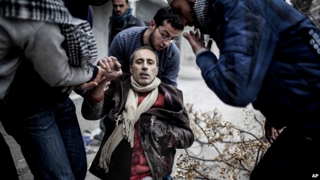 Thường dân bị thương sau một vụ tấn công súng cối tại khu phố Saif al-Dawlah ở Aleppo, Syria, ngày 13/1/2013.