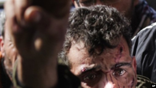 A wounded fighter is brought into a the Ras Lanuf Hospital from the battle in Bin Jawad on March 6, 2011.